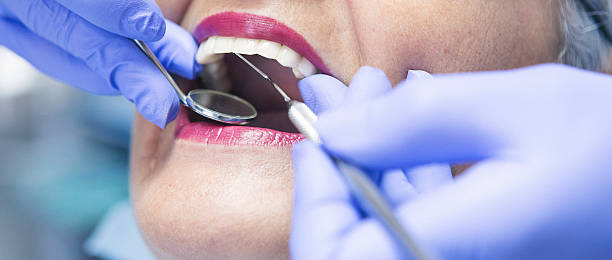 Best Emergency Root Canal Treatment in Granite Falls, NC